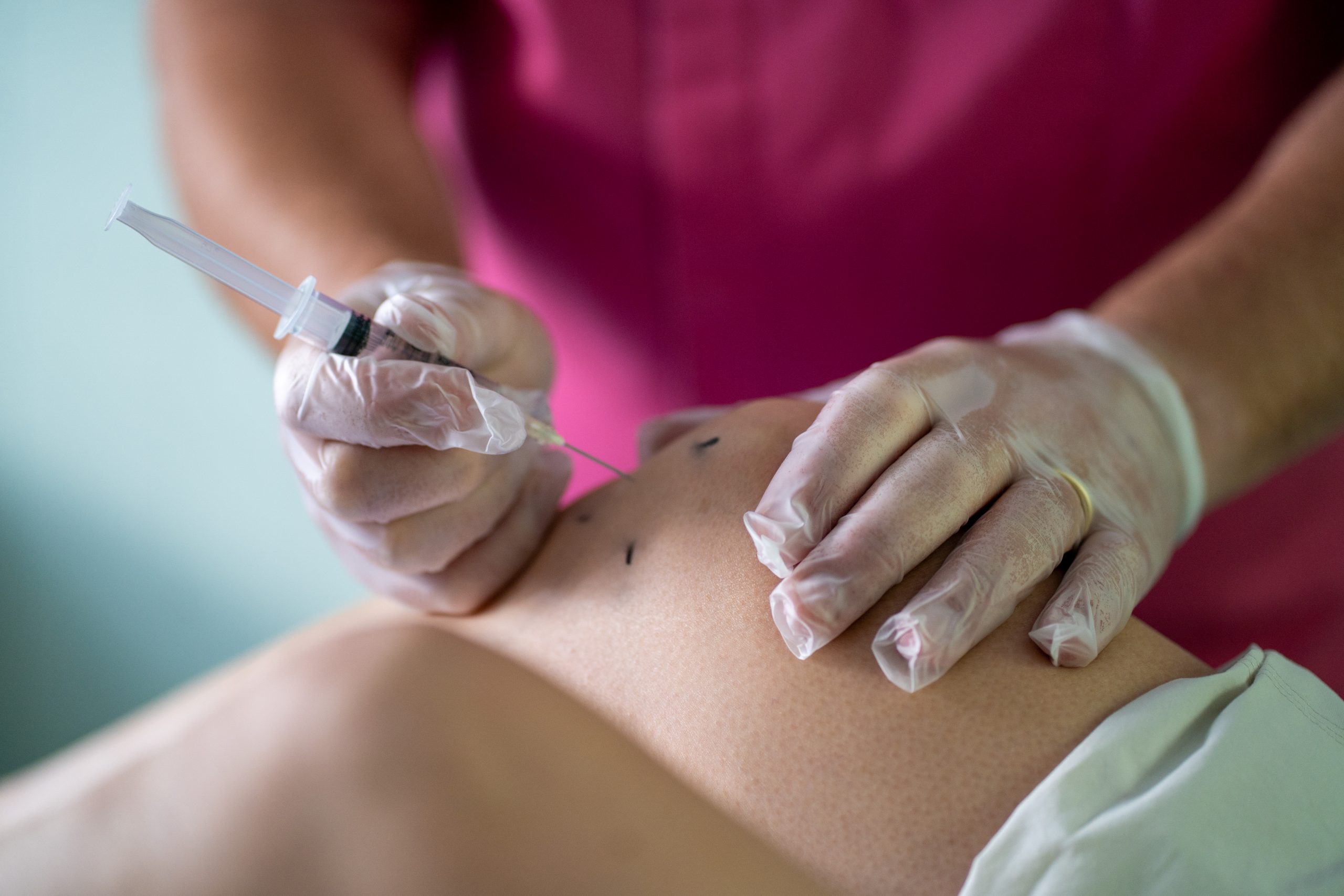 Ozone Therapy for Arthritis Pain Relief